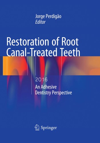Restoration of Root Canal-Treated Teeth 2016