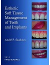 final . jeld - 370 - RP - Esthetic Soft Tissue Management of Teeth and Implants.jpg