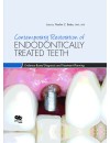 final . matn - 677 - RP -Contemporary Restoration of Endodontically Treated Teeth Evidence-Based Diagnosis and Treatment Planning.jpg