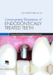 Contemporary Restoration ENDODONTICALLY TREATED TEETH Evidence Based Diagnosis and Treatment Planning 2013