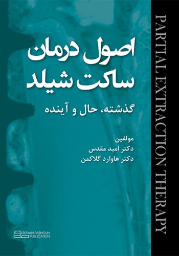 اصول درمان ساکت شیلد؛ گذشته،حال و آینده
