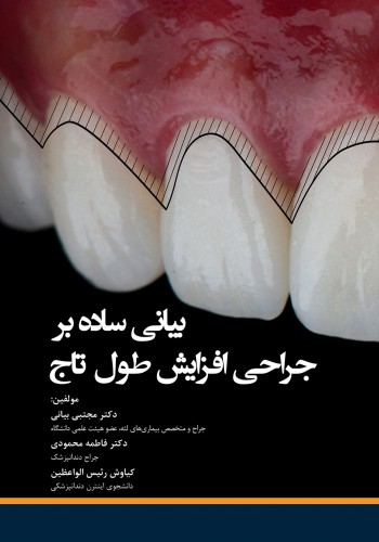 بیانی ساده بر جراحی افزایش طول تاج