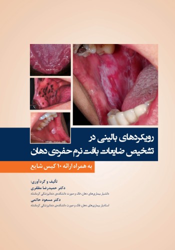 رویکرد های بالینی در تشخیص ضایعات بافت نرم حفره ی دهان به همراه ارائه 10 کیس شایع
