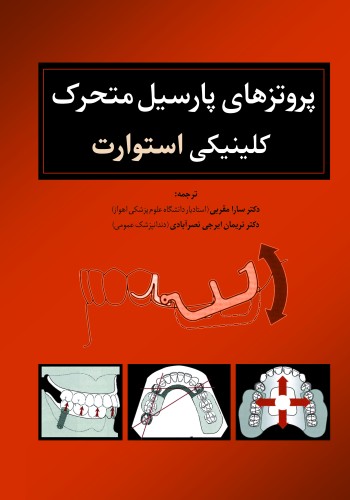  پروتزهای پارسیل متحرک کلینیکی استوارت