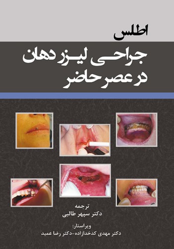 اطلس جراحی لیزر دهان در عصر حاضر