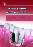 مراقبت و نگهداری از ایمپلنت‌های دندانی