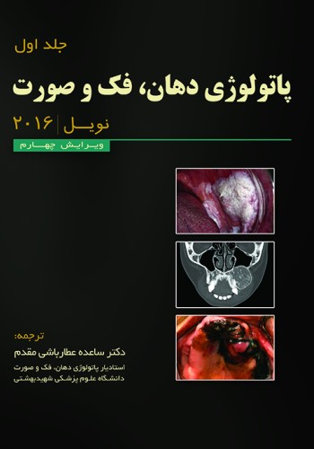 پاتولوژی دهان،فک و صورت - نویل 2016 (جلد اول)- رنگی
