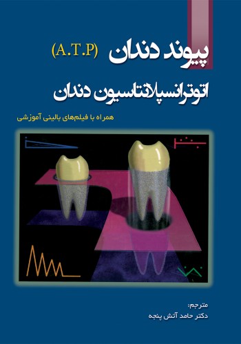 پیوند دندان اتوترانسپلانتاسیون دندان (A.T.P)