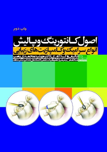 اصول کانتورینگ و پالیش انواع سرامیک و کامپازیت های زیبایی