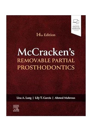 McCrackens REMOVABLE PARTIAL PROSTHODONTICS 2026