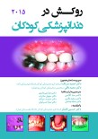 روکش در دندانپزشکی کودکان