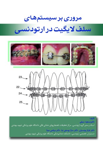 مروری بر سیستم های سلف لایگیت در ارتودنسی