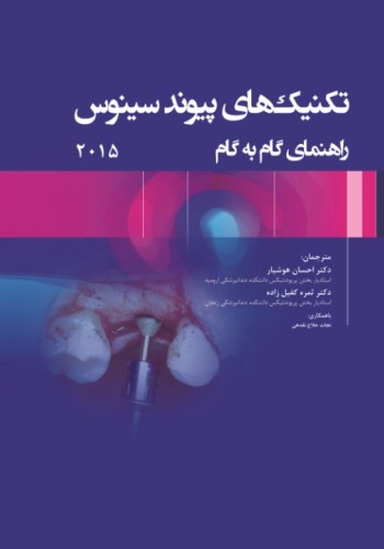 تکنیک‌های پیوند سینوس؛ راهنمای گام به گام