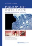 Peri-Implant Infection 2009