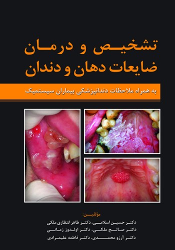 تشخیص و درمان ضایعات دهان و دندان