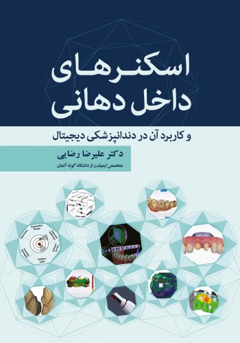 اسکنرهای داخل دهانی و کاربرد آن در دندانپزشکی دیجیتال