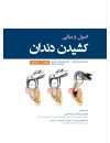 اصول و مبانی کشیدن دندان.jpg