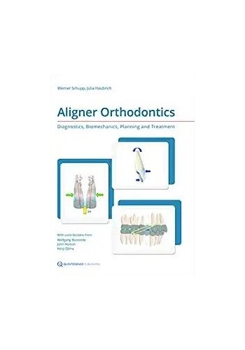Aligner orthodontics diagnostic biomecanics planning and treatment 2016