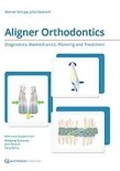 Aligner orthodontics diagnostic biomecanics planning and treatment 2016