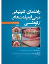 جلد مینی ایمپلنت.jpg