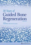  .30Years of Guided Bone Regeneration in Implant Dentistry 2022