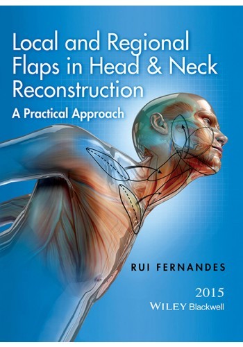 Local and Regional Flaps in Head and Neck Reconstruction