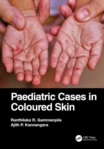 Paediatric Cases in Coloured Skin 2023