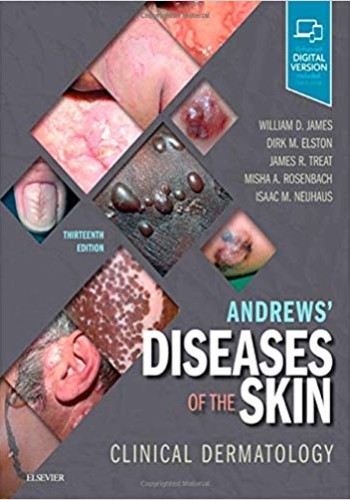 Andrews' Diseases of the Skin: Clinical Dermatology2019
