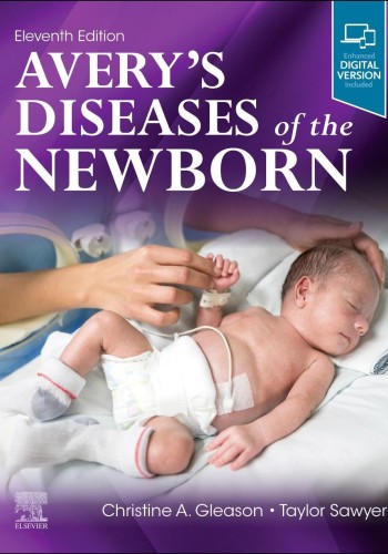 Avery's Diseases of the Newborn 2023- 2vol