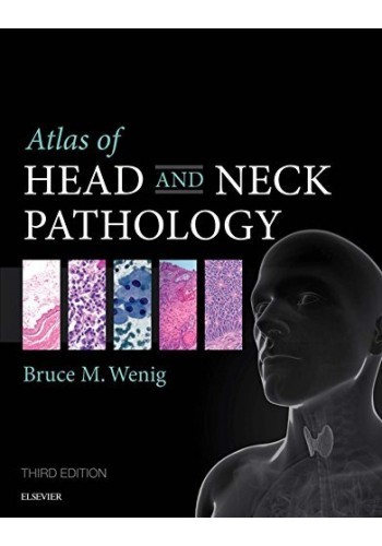 ATLAS OF HEAD AND NECK PATHOLOGY