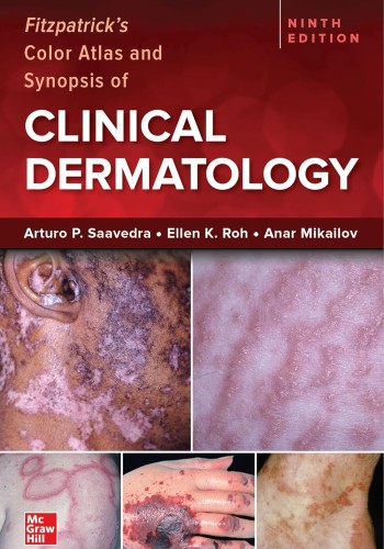 Fitzpatrick's Color Atlas and Synopsis of Clinical Dermatology 2023