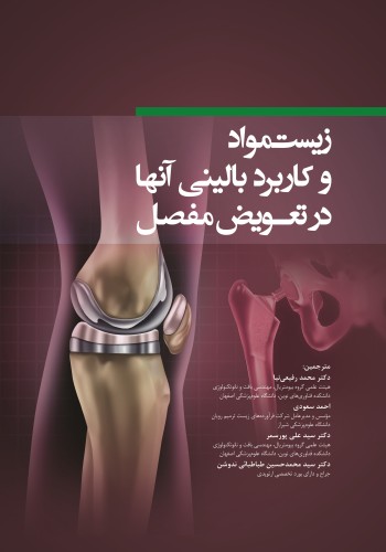 زیست مواد و کاربرد بالینی آنها در تعویض مفصل