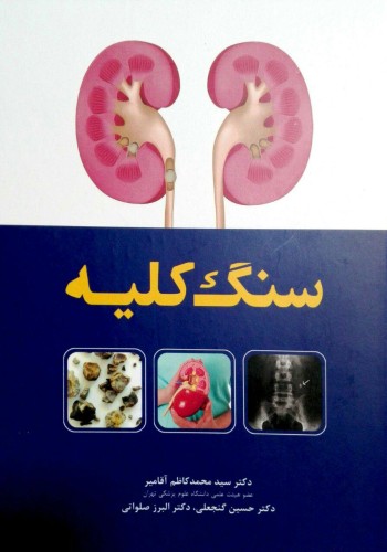 سنگ کلیه