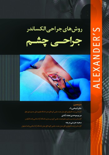 روش های جراحی الکساندر 2019 جراحی چشم