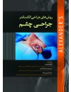 روشهای جراحی الکساندر جراحی چشم.jpg